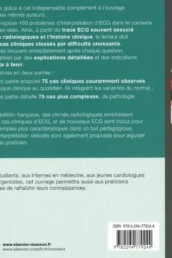 150 cas cliniques d'ECG. 2e édition, John R. Hampton